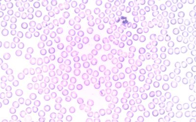 Keep an eye on White Blood Cells